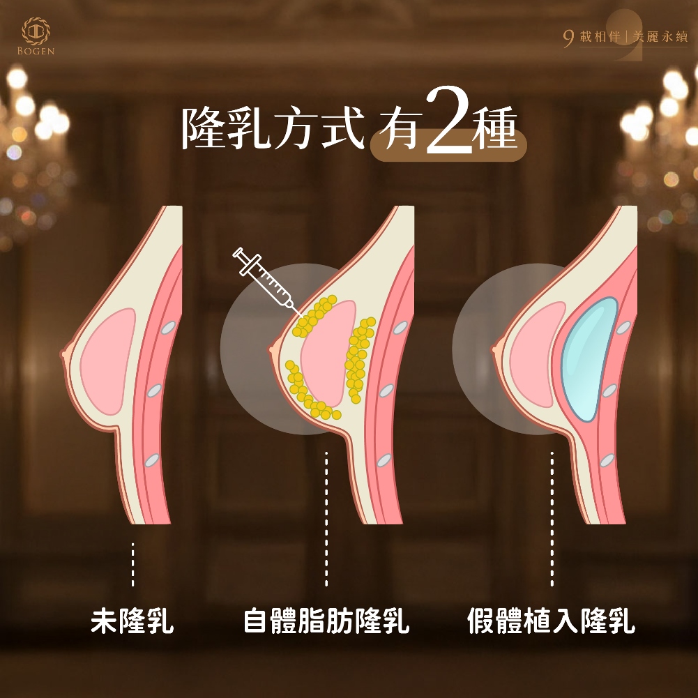 隆乳方式分假體隆乳與自體脂肪隆乳,博恩妍